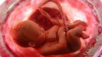 Hamilelikte Kan Uyuşmazlığı